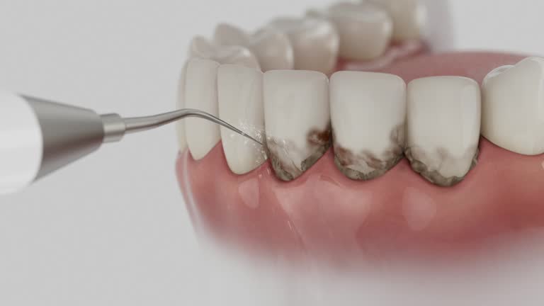 Reliable Emergency Dentist contractor in Angleton, TX by Smile Center Dentistry
